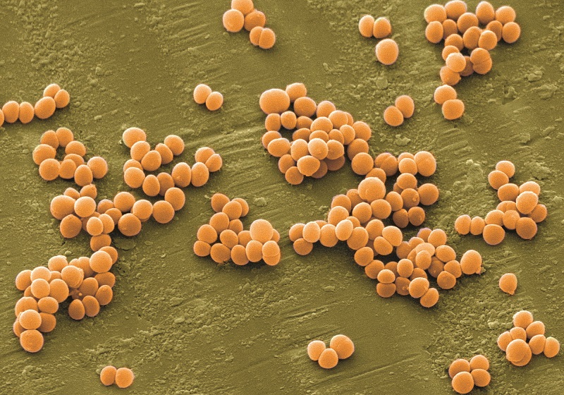 Staphylococcus aureus (Tụ cầu vàng)